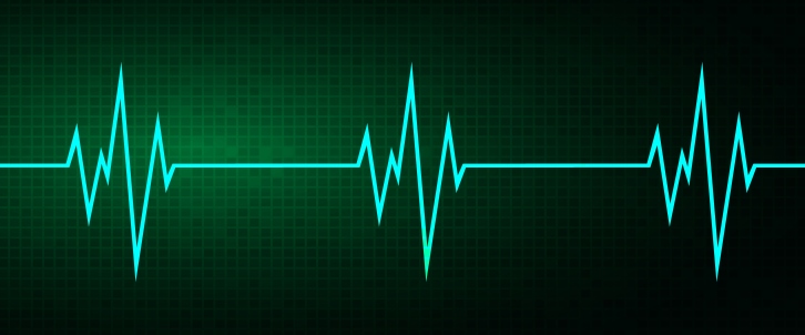 Measuring the pulse of your network | Part 1 | Blog | EXFO