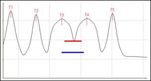 A traditional OSA makes use of the interpolation method to measure the noise at the level of the red bar